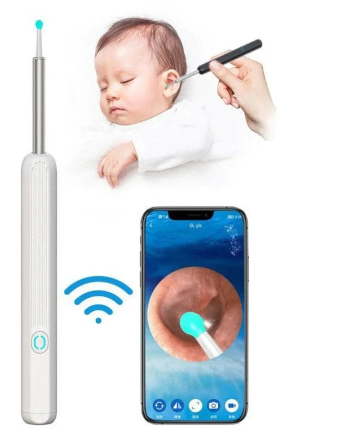 Earwax Removal Kit with Camera | مجموعة إزالة شمع الأذن مع كاميرا