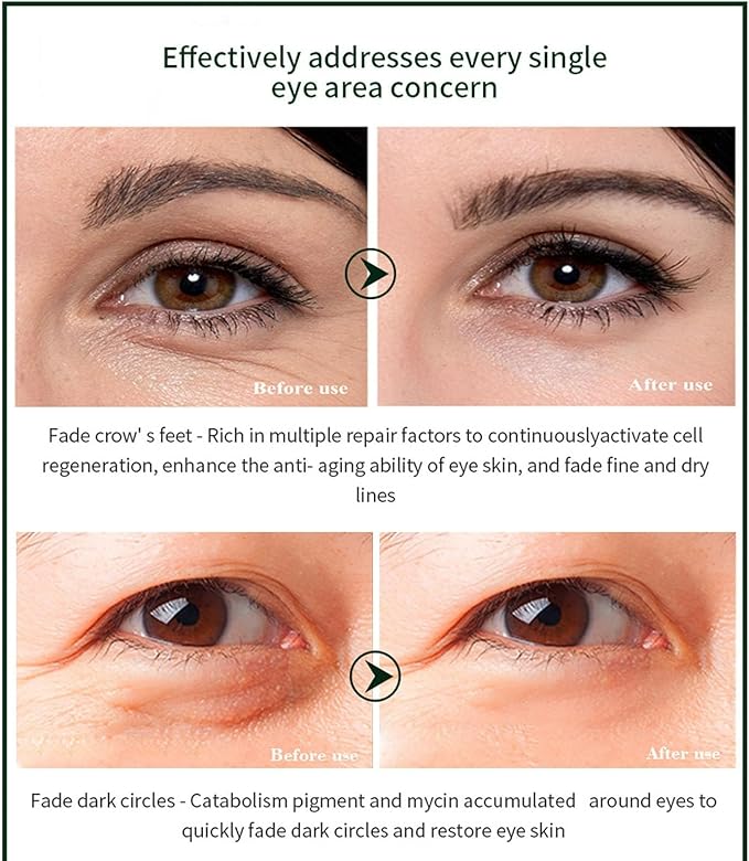 Time Eraser Eye Roller 10ml – Under-Eye Roll-On for Puffiness, Dark Circles & Fine Lines