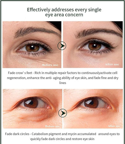 Time Eraser Eye Roller 10ml – Under-Eye Roll-On for Puffiness, Dark Circles & Fine Lines